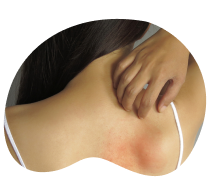 Болезнь Стилла у взрослых